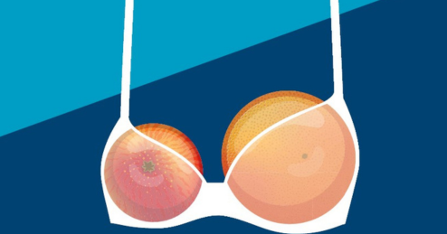 Let's Talk About Uneven Breasts